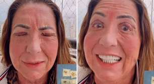 Mãe de Virginia surge irreconhecível após cirurgia nos olhos: 'Não está bonito'
